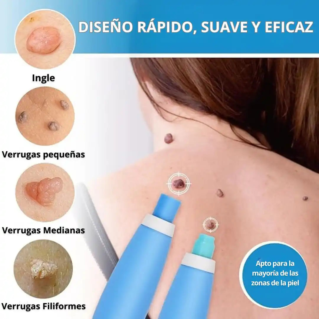 TagBuddy® – Kit Removedor de Verrugas | precisa y sin molestias