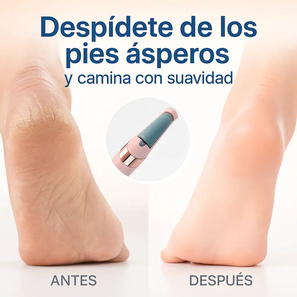 SoftFeet™ – Removedor de Callos Portátil | Pies Suaves al Instante, Sin Dolor