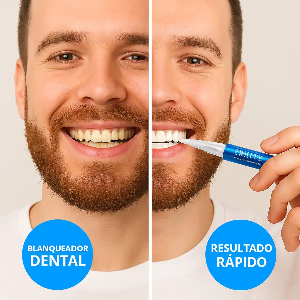 Smile white™ | Combo Blanqueador + Limpieza Dental Profesional en Casa