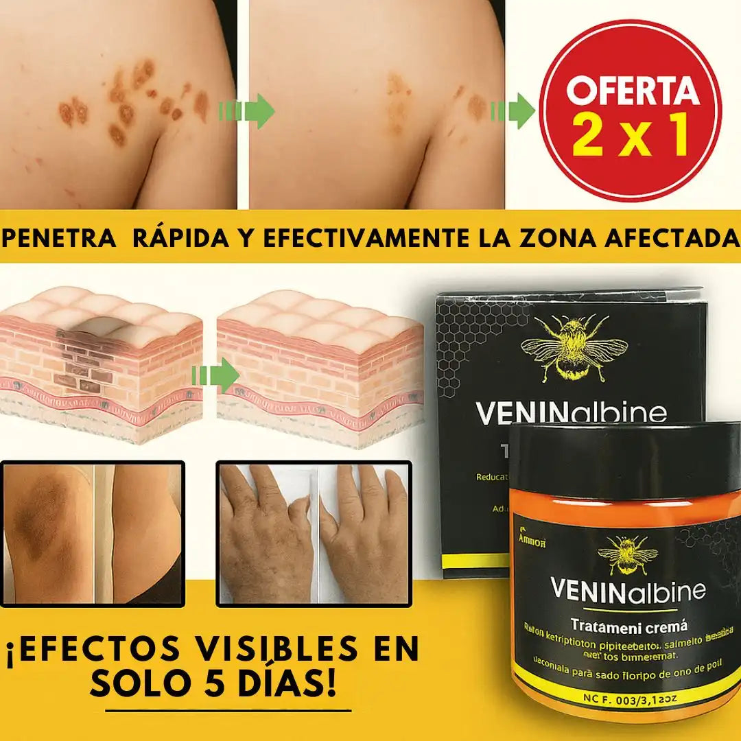 Bee Venom™ – Crema Veneno de Abeja | Alivio Natural para Tus Articulaciones